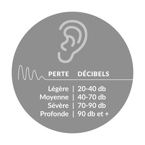 Pertes auditives en décibels